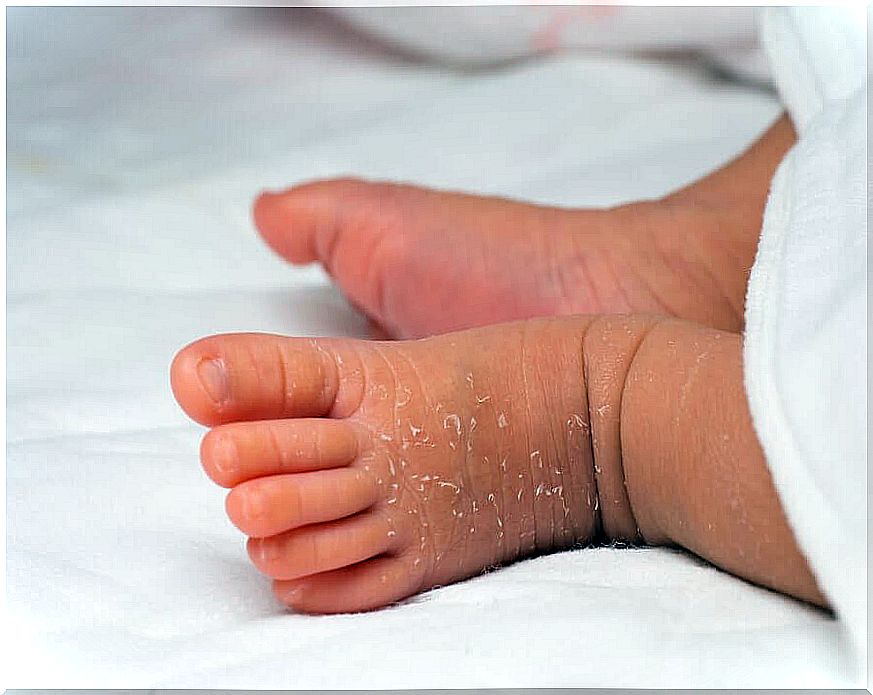 How to care for your newborn's skin